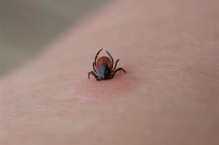 How to remove a tick